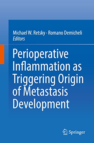 Perioperative Inflammation as Triggering Origin of Metastasis Development (English Edition)